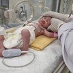 ‘가자의 기적’ 숨진 엄마 뱃속서 살아남은 아기, 출생 5일 만에 숨져