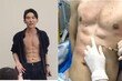 “운동 대신 주사 40번”…8억 들여 인공 복근 만든 中 남성