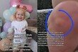 “3살 아이 통증, 괜찮다는 말 믿지 않았다”…희귀병 징조 찾아낸 英 엄마