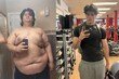211→87㎏ 감량한 20대 “3년간 ‘칼로리 적자’ 이루려 사투”