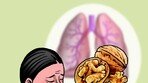 폐에 좋은 ‘폐 닮은 호두’… 허리 통증에도 효능[이상곤의 실록한의학]〈149〉
