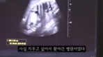 [단독]‘36주 낙태’ 20대女, 50대 교제남이 수술비 내주고 떠났다[더뎁스]