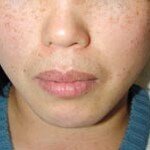 얍! 피부 나이 거꾸로 먹어라