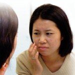 환절기 피부 불청객 ‘여드름’