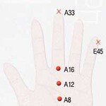 뇌졸중엔 양손 A33번에서 사혈로 응급처치 