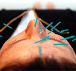 경락에서 ‘줄기세포’ 찾았다?