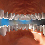 진찰료 부풀리고, 재료비 떼먹고