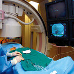 영상의학 분야의 암 치료