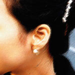 美와 運 동시에…‘귀 성형’ 뜬다