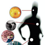 당뇨보다 10배 무서운 ‘당뇨합병증’