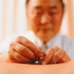 국제 표준화 놓고 ‘鍼 삼국지’