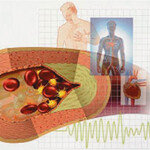 봄 운동 무리하면 혈관이 놀라요!