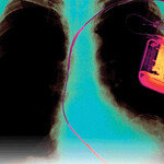 컴퓨터 바이러스 인간 습격 경고등