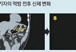 [이진한의 메디컬 리포트]기자가‘먹방’에 도전한 이유