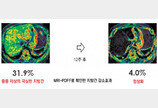 지방간-염증-섬유화 개선 신약 물질… 다중 표적 치료 효과로 해외서 주목