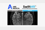 에어스메디컬, 獨·英·日에 MRI AI 솔루션 SwiftMR™ 공급 계약 체결