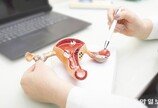 증상 없는 난소암…국내 난소암 환자의 10명 중 7명 진단 받으면 3기 이상