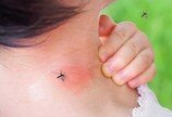 ‘스키터 증후군’, 당신이 몰랐던 모기 알레르기