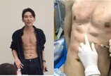 “운동 대신 주사 40번”…8억 들여 인공 복근 만든 中 남성