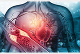 나쁜 콜레스테롤보다 6배 더 위험한 ‘지단백질’