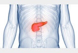 암 생존율 70% 시대, 췌장암만 한·미·일 모두 10%대… 왜?