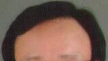 산재 없는 나라, ‘사고 대응’에서 ‘위험 예방’으로[기고/김종인]