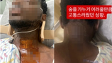 “안전 걱정 말라더니”…광고 촬영 중 외국인 모델 목 골절