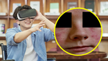 VR기기 쓰고 게임했더니 얼굴에 붉은 반점…‘이것’ 때문이었다