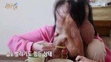 신경 섬유종 앓는 女, 충격적 모습에 누리꾼 폭발