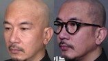 구준엽 탈모 극복? ‘두피에 무슨 짓을…’ 충격