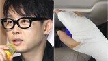 이승환, 수술대 위로…모든 공연 취소