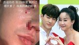 함소원, 남편 진화 피투성이 폭행 논란 입 연다 “고민 끝에 결정”