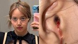 블랙핑크 리사, 귀에서 피 철철? 어머, 무슨 일이…