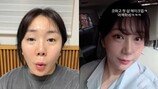 ‘구축 피해’ 허안나, 재성형 후 달라진 얼굴 “누구세요?”