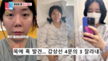 허안나 수술, ‘박나래 여파’로 실직 이어 ‘악재’