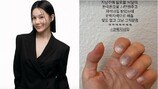 아이비, 14만 원 미국 네일 분노…“코딱지색 그지같음”