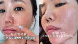 43세 강예빈 근황, 피부 다 뒤집어지고 난리나 ‘끔찍’