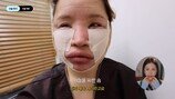라뮤끄, 얼굴 지방 흡입 극심한 고통 ‘상태 심각’