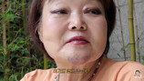 이혜정, 멍투성이 얼굴+몸…대체 무슨 일