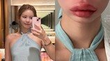 맹승지, 필러 입술 터질 것 같아 ‘끔찍’