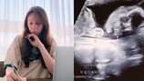 ‘박주호♥’ 안나, 암투병→깜짝 근황 “소중한 아기”