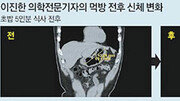 [이진한의 메디컬 리포트]기자가 ‘먹방’에 도전한 이유