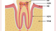 시리고 아픈 치아, 원인 모두 달라… 내원해 확인을[홍은심 기자의 긴가민가 질환시그널]