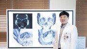 얼굴뼈도 3D프린터로…최첨단 안면재건술의 세계[건강 기상청 : 증상으로 본 질병]