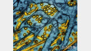 美워싱턴주 노인, 조류인플루엔자 감염돼 숨져…H5N5형 첫 사례