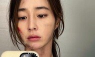 ‘이병헌♥’ 이민정 “씻기 전에…” 얼굴 상처 왜?
