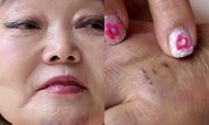 이혜정, 멍투성이 얼굴+몸…대체 무슨 일