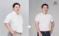 정형돈 맞아? 10kg 감량 효과 충격적…비주얼 무슨 일?