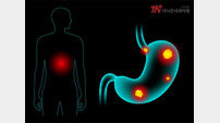 위내시경 검사, 위암 조기 발견의 열쇠 [건강 올레길]