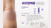 “여름이 두려운 하지정맥류”